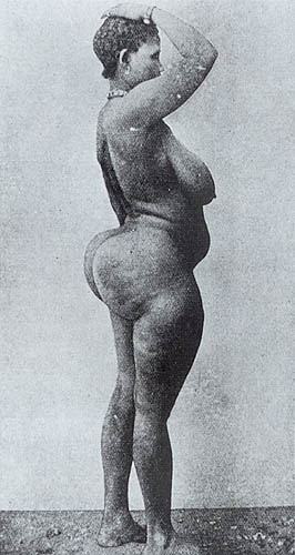 File:Woman with steatopygia.jpg - Wikimedia Commons