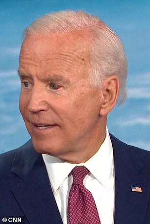 Biden's eye fills with blood during town hall - 24hourcampfire