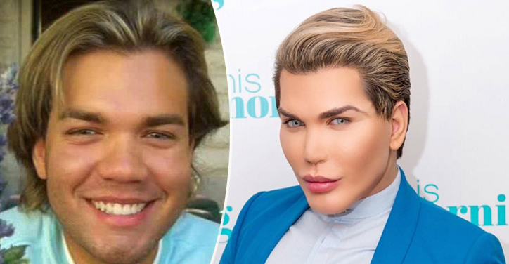 Rodrigo-Alves-31-interventi-e-230-mila-dollari-spesi-per-assomigliare-a-Ken.jpg