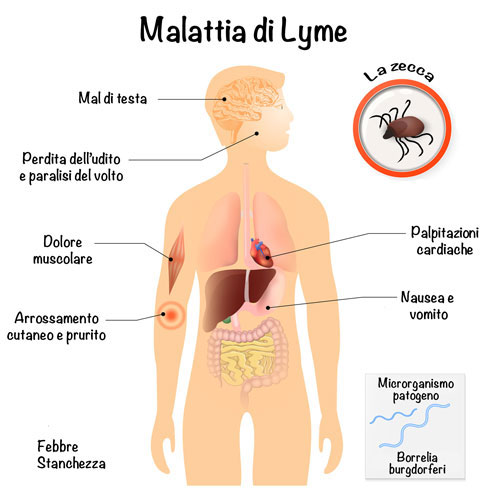 malattia di Lyme trasmissibile all'uomo